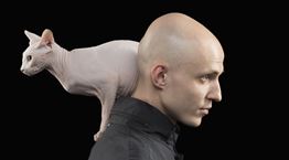 Βρέθηκε το φάρμακο κατά της φαλάκρας;