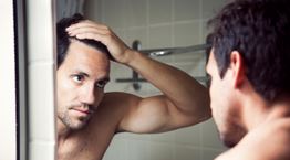 3 τρόποι για να δώσεις τέλος στην τριχόπτωση και την αραίωση μαλλιών