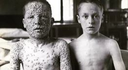 Πώς τα εμβόλια εξόντωσαν την ευλογιά και όχι μόνο