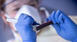 Αιματολογικός δείκτης προβλέπει ποιοι θα νοσήσουν σοβαρά από COVID-19