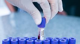 Το ποσοστό των πραγματικά ασυμπτωματικών με κορονοϊό σύμφωνα με νέα έρευνα