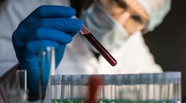 Η ομάδα αίματος που είναι η πιο ευάλωτη στον κορονοϊό