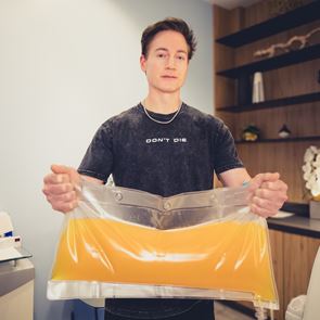 Mεγιστάνας αφαίρεσε &#39;όλο το πλάσμα από το σώμα του&#39; για να δείχνει νεότερος