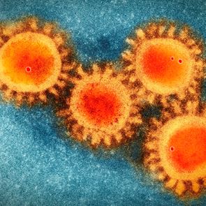 Κορονοϊός: Έξαρση ή δεύτερο κύμα στην Ευρώπη