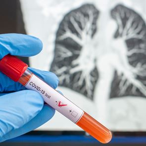 Ξεκίνησε η μετάγγιση πλάσματος από όσους ανέρρωσαν σε ασθενείς με &lt;em>κορονοϊό&lt;/em>