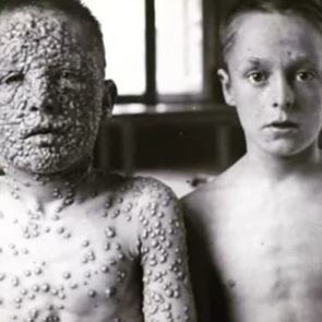 Πώς τα εμβόλια εξόντωσαν την ευλογιά και όχι μόνο