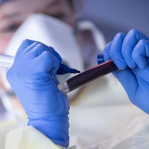 Αιματολογικός δείκτης προβλέπει ποιοι θα νοσήσουν σοβαρά από &lt;em>COVID&lt;/em>-19