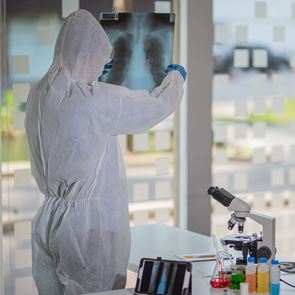 Τι είναι η &quot;καταιγίδα κυτταροκινών&quot; και πώς συνδέεται με τον κορονοϊό