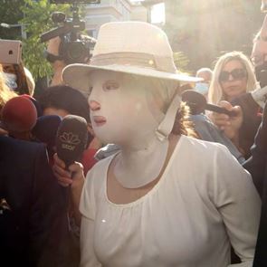 &quot;Δεν είχα ξαναδεί ποτέ μου άνθρωπο χωρίς πρόσωπο