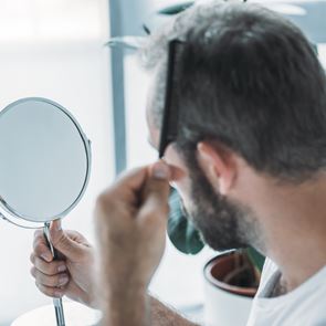 Όλη η αλήθεια για τη μεταμόσχευση μαλλιών