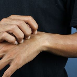 Τα κουνούπια σε τσιμπάνε γιατί είσαι &#39;γλυκοαίματος&#39; - Τι λέει η επιστήμη