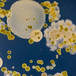 Ένας μύκητας &#39;σπέρνει&#39; τον πανικό στα νοσοκομεία. Αλλά γιατί