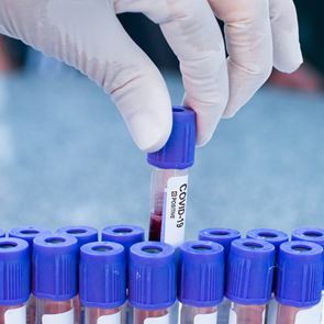 Το ποσοστό των πραγματικά ασυμπτωματικών με &lt;em>κορονοϊό&lt;/em> σύμφωνα με νέα έρευνα