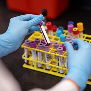 Τι είναι τα ορολογικά τεστ αντισωμάτων