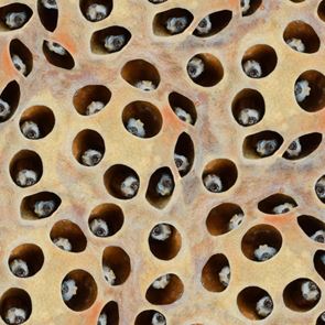 Τι είναι πάλι αυτή η τρυποφοβία