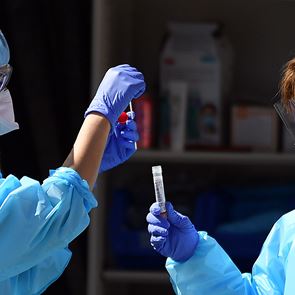 Οι επιστήμονες ρίχνουν σταδιακά φως σε ένα από τα άλυτα μυστήρια του κορονοϊού