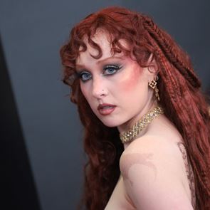 Όλοι μιλούν για την topless εμφάνιση της Chappell Roan στα Grammys 2026