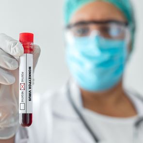 Η &lt;em>Ευρώπη&lt;/em> παραγγέλνει εμβόλια για την ευλογιά των πιθήκων