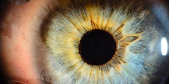 Κι όμως, υπάρχει ένα χρώμα ματιών που έχει μόνο το 1% του πληθυσμού