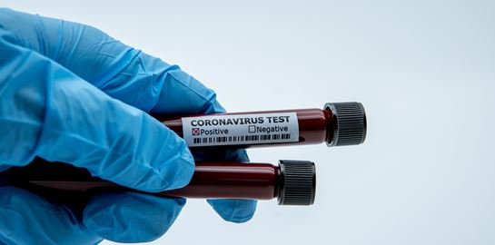 Το πρώτο κρούσμα της βρετανικής μετάλλαξης του κορονοϊού επιβεβαιώθηκε στην Νέα Υόρκη