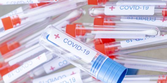 Τα νέα τεστ εξπρές για τον κορονοϊό θυμίζουν τα τεστ εγκυμοσύνης