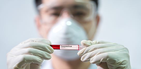 Ο ΠΟΥ διερευνά την προέλευση της COVID-19