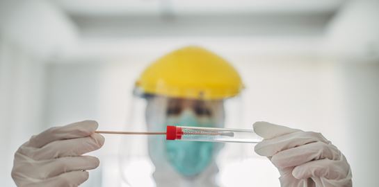 Είναι πολύ πιθανό να ζήσουμε ένα δεύτερο κύμα κορονοϊού