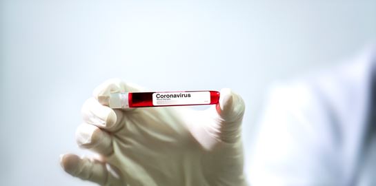 Ο Ηλίας Μόσιαλος εξηγεί γιατί θα είναι επικίνδυνο να ξεφύγει το νέο στέλεχος του κορονοϊού