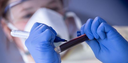 Αιματολογικός δείκτης προβλέπει ποιοι θα νοσήσουν σοβαρά από COVID-19