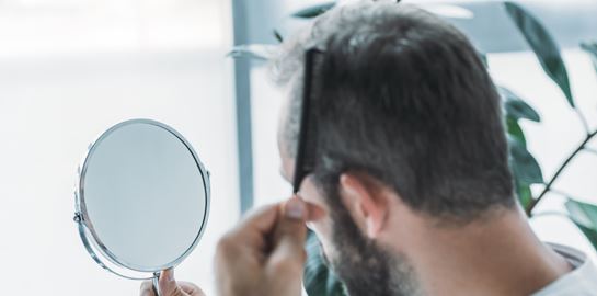 Όλη η αλήθεια για τη μεταμόσχευση μαλλιών