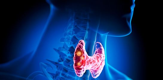 Αφαίρεση Θυρεοειδούς (Θυρεοειδεκτομή): Θα αλλάξει η ζωή μου μετά την επέμβαση; Τι πρέπει να περιμένω;