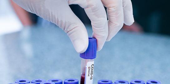 Το ποσοστό των πραγματικά ασυμπτωματικών με κορονοϊό σύμφωνα με νέα έρευνα