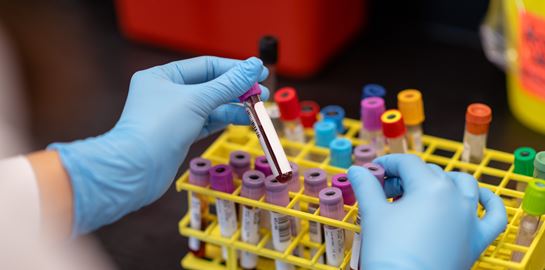 Τι είναι τα ορολογικά τεστ αντισωμάτων