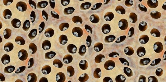 Τι είναι πάλι αυτή η τρυποφοβία;