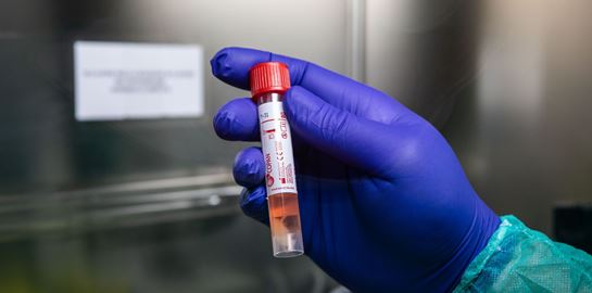 5 μύθοι για τον κορονοϊό