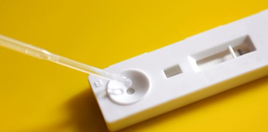 Νέο διαγνωστικό τεστ ανιχνεύει τον SARS-CoV-2 σε μόλις 5'