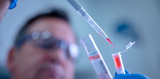 Γάλλος επιστήμονας ισχυρίζεται ότι θεράπευσε 1.003 ασθενείς με υδροξυχλωροκίνη