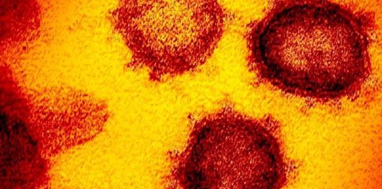 Πώς συμπεριφέρεται ο κορονοϊός στον οργανισμό, σύμφωνα με έναν ειδικό