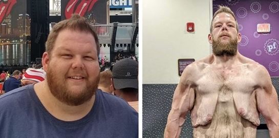 Ένας άντρας έχασε 152 κιλά και ιδού τα αποτελέσματα