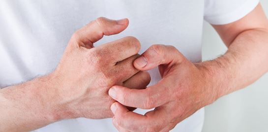 Είναι επικίνδυνο να κάνουμε κρακ στα δάχτυλά μας;