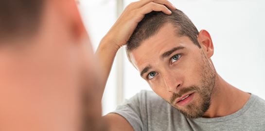 Τι είναι οι influencers τριχόπτωσης και γιατί πρέπει να τους ακολουθήσεις χθες