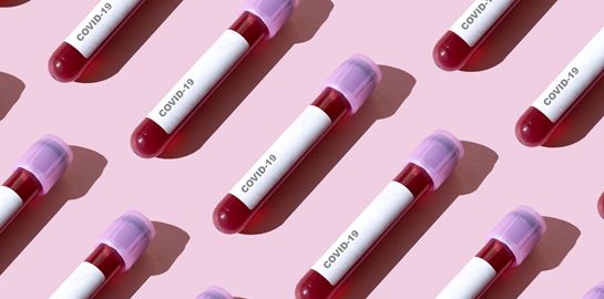 Πότε θα είναι έτοιμο ένα αποτελεσματικό εμβόλιο για τον κορονοϊό