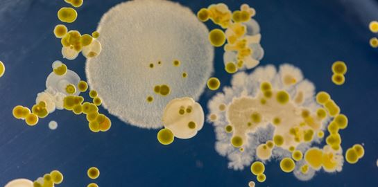 Ένας μύκητας &#39;σπέρνει&#39; τον πανικό στα νοσοκομεία. Αλλά γιατί;