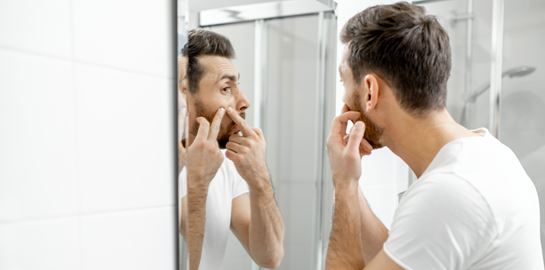 Ακμή ενηλίκων: Αιτίες εμφάνισης και τρόποι αντιμετώπισης