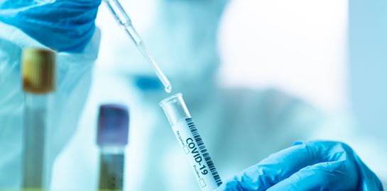 Τα 3 σενάρια για την εξέλιξη του κορoνοϊού