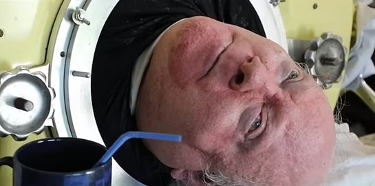 &#39;Έφυγε&#39; από τη ζωή ο Paul Alexander