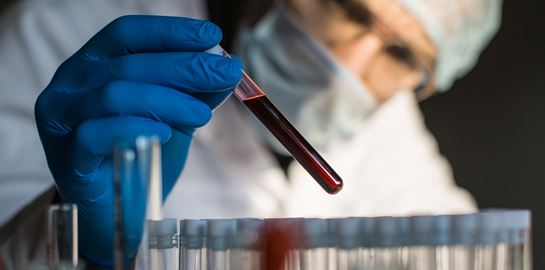 Η ομάδα αίματος που είναι η πιο ευάλωτη στον κορονοϊό