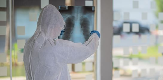 Τι είναι η &quot;καταιγίδα κυτταροκινών&quot; και πώς συνδέεται με τον κορονοϊό