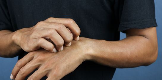 Τα κουνούπια σε τσιμπάνε γιατί είσαι &#39;γλυκοαίματος&#39; - Τι λέει η επιστήμη, όμως;