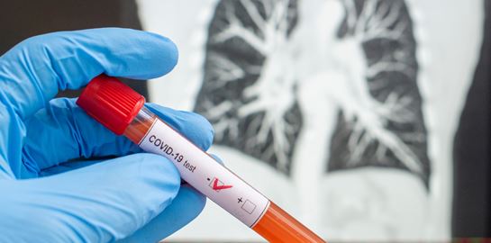 Ξεκίνησε η μετάγγιση πλάσματος από όσους ανέρρωσαν σε ασθενείς με κορονοϊό